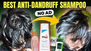 Best Anti Dandruff shampoo *NOT SPONSORED*