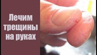 МАЗЬ ПРИ ТРЕЩИНАХ НА РУКАХ