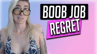 I (Almost) Regretted My Boob Job | Trans Breast Augmentation | MTF Transgender Transition