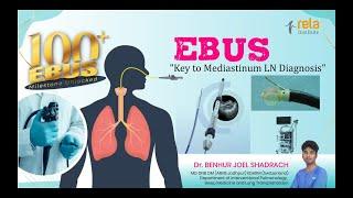 EBUS - Mediastinum LN Diagnosis, by Dr. Benhur Joel Shadrach #relahospital #health #healthcare