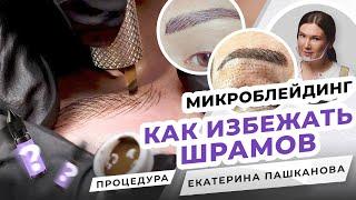 МИКРОБЛЕЙДИНГ БРОВЕЙ. Как избежать шрамов? Форма бровей | Мастер Екатерина Пашканова