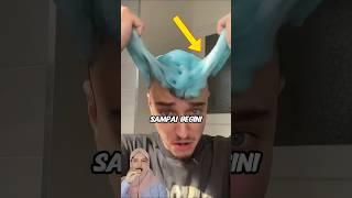 Rambut pria ini terjebak slime 