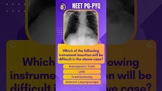 NEET PG PYQs - Radiology |High Yield MCQs |Image Based |INICET | MRB | #neetpg #fmge #inicet #mrb