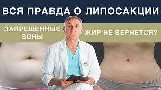 ЛИПОСАКЦИЯ ЖИВОТА, БЕДЕР КАК УБРАТЬ ЖИР БЕЗОПАСНО, БЫСТРО И НАДОЛГО