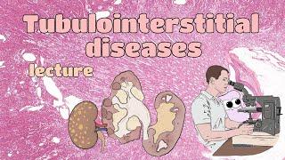 Pathology - Tubulointerstitial diseases (EN)