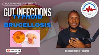 11/12/2024 - GUT INFECTIONS; TYPHOID, BRUCELLOSIS