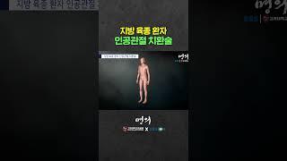 지방에 생긴 종양, 수술은 어떻게 할까?