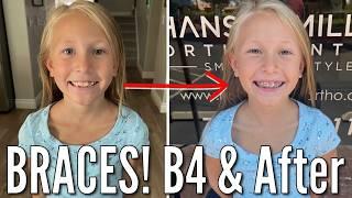 She's Getting Braces! | 8 Year Old Goes to the Orthodontist to Get Braces Put On