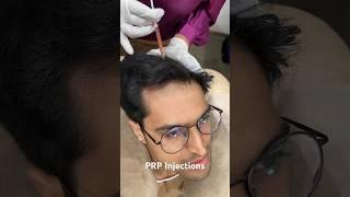 PRP Treatment For Hair loss | Best Hair Regrowth Treatment For Men #prptreatment