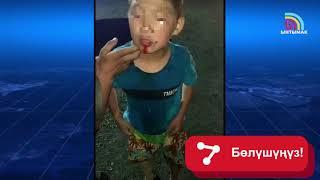 Ошто кутурган ит жаш баланы тиштеп алды | #Ынтымак