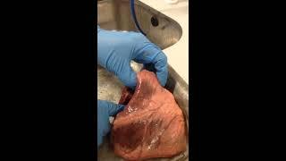 Mary Khumalo - Dissection of the heart