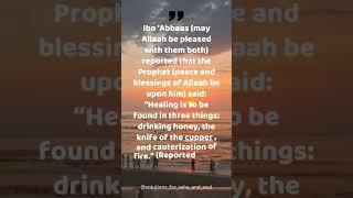 Hijama in Hadeeth #solutions_for_seha_and_soul