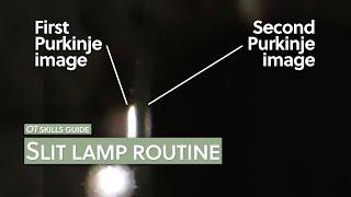 OT skills guide: Slit lamp routine