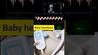 Baby heartbeat at 7months pregnancy #doppler#heartbeat #shorts