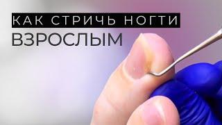 Как правильно стричь ногти взрослым?