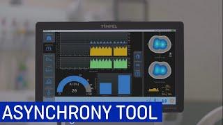 Timpel Asynchrony Tool