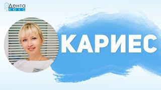 Кариес - причины, лечение и профилактика. Сколько нужно посещений? Как снять боль?