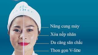 Trẻ Hóa - Xóa Nhăn Với Thermage Flx Hàng Đầu Thế Giới - Daimec Hải Phòng