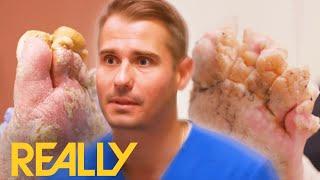 Most SHOCKING Foot Conditions Ever! | My Feet Are Killing Me