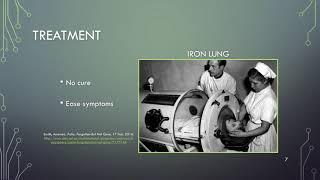 Poliomyelitis video