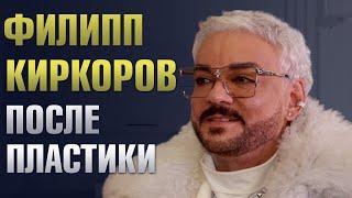 Какие пластические операции сделал Филипп Киркоров? Киркоров До и После пластики