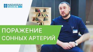  Лечение атеросклероза сонных артерий - какие методы? Лечение атеросклероза сонных артерий. 12+