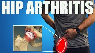 HIP OSTEOARTHRITIS.  BEST Exercises, Stretches & Advice for Hip & Groin Pain Relief