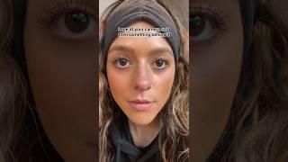 Divergence  #divergence #trending #viral #fyp #eyes #fypシ #vision #eyedoctor #optometry