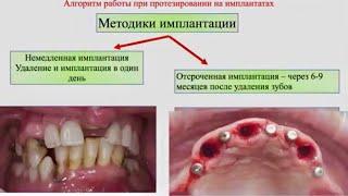 Все ТОНКОСТИ протезирования на имплантатах: основы взаимодействия ортопеда и хирурга. Арам Давидян