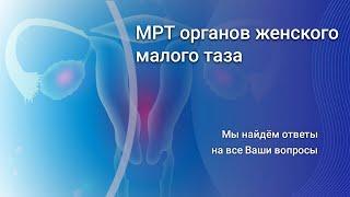 МРТ органов женского малого таза