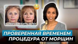 Альтернатива лазерному омоложению: трихлоруксусный пилинг // Как избавиться от морщин и постакне