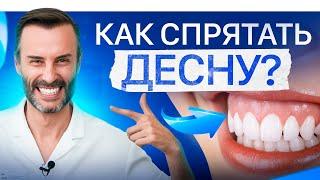 Десневая улыбка. Кто поможет – ортодонт, хирург или косметолог?