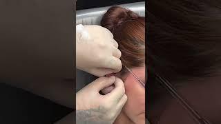 Daith piercing procedure | watch the processes #earring #piercing #bodymodification #daithpiercing