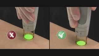 A GentleMax Pro  detailed introduction