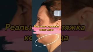 ЭТО можно убрать и ЛИЦО СТАНЕТ МОЛОЖЕ! // #советыкосметолога #докторщербатова