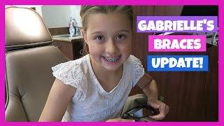GABRIELLE GETS BRACES | EPISODE 21 | THE WEISS LIFE