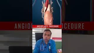 Angioplasty - Explained by EECP Expert