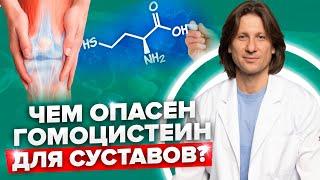 Как гомоцистеин разрушает ваши суставы? Кто же находится в зоне риска?