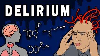 DELIRIUM - Causes, Symptoms, Physiology