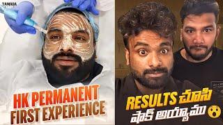 HK Permanent First Experience | Result చూసి Shock అయ్యాము | Rj Chaitu | Rj Chaitu Vlogs