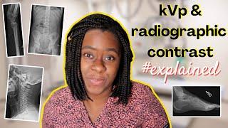 kVp & radiographic contrast explained || Ask The Rad Tech