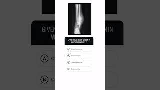 Comment ur explanation & name the appearance in x-ray image…. #medicos #mbbs #medicaldoctor