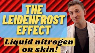 What is the Leidenfrost Effect? History and Liquid nitrogen on skin!