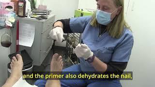How to fix an ingrown toenail painless.