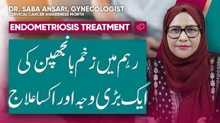 Is Endometriosis Treatable? Facts & Myths Explained | Dr.Saba Ansari | MISA Women Health & Solutions