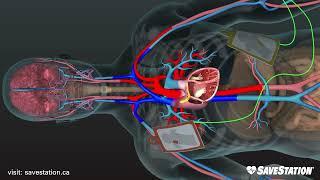 DUTCH: AED in actie | Een 3D-kijkje in het lichaam