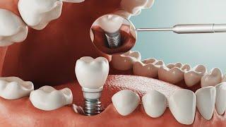 A Guide to Restorative Dentistry