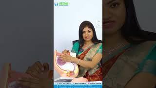 journey through the intricacies of Placenta Previa |  Unittas Multispeciality Hospital, Chennai