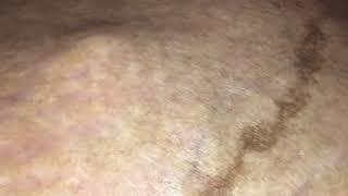 Stacys active belly