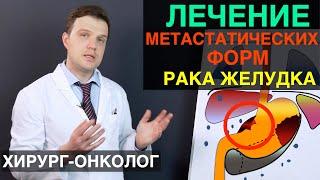 Рак желудка - лечение метастатических форм